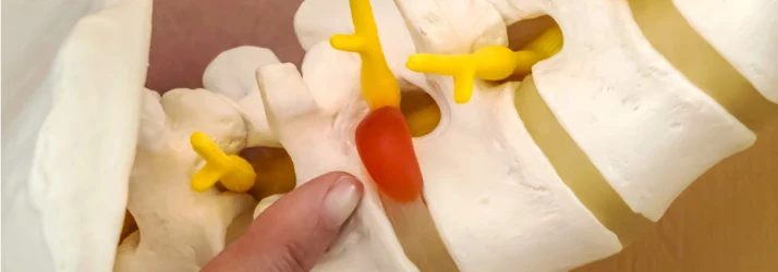 What to Expect During a Spinal Decompression Session in Louisville KY