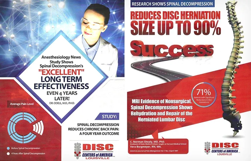 Informational posters about spinal decompression benefits, highlighting long-term effectiveness and disc herniation reduction.